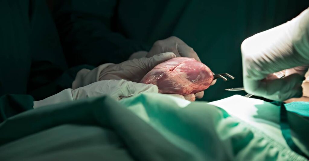 Maranhão realiza primeiro transplante de coração pelo SUS