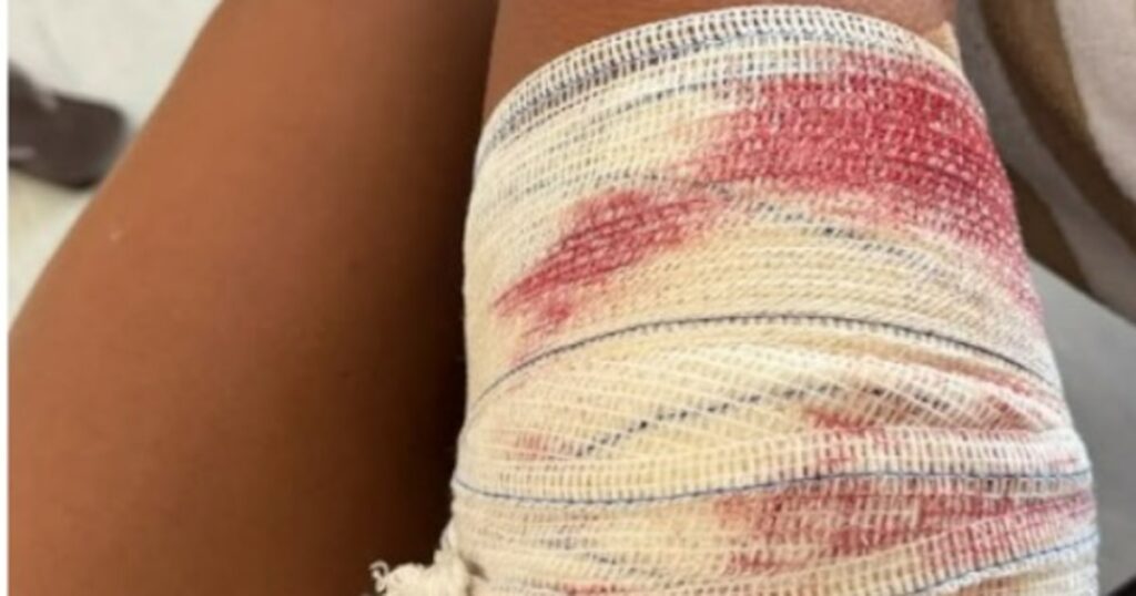 Turista de SP é mordida por tubarão ao mergulhar em Fernando de Noronha